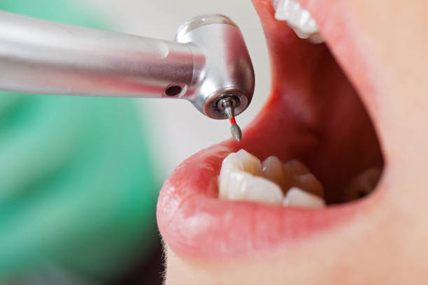 Best Emergency Pediatric Dental Care in Fredericksburg, VA